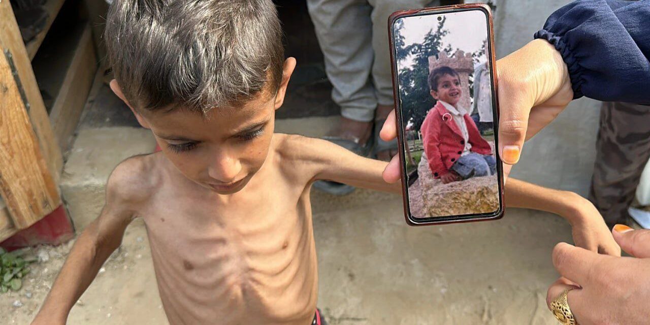 Fome em Gaza: UNRWA alerta que mortes são “muito superiores” aos números oficiais