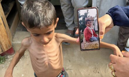Fome em Gaza: UNRWA alerta que mortes são “muito superiores” aos números oficiais